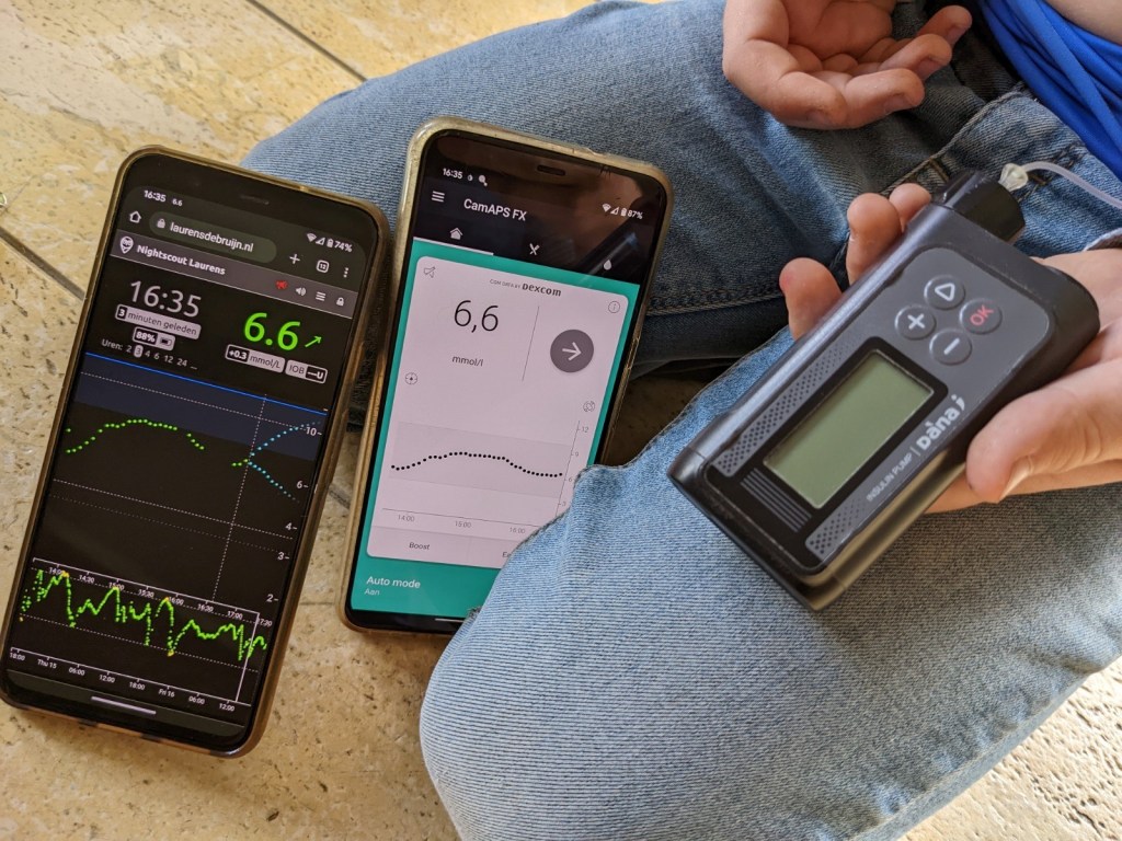 CamAPS & de Dana-i | Interview met de vader van een kind met&nbsp;T1D